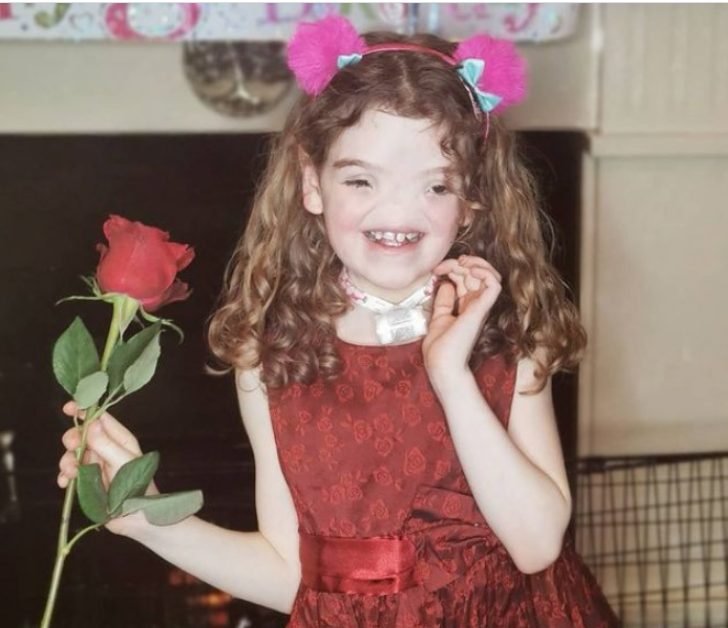  Bambina Unica Senza Naso La Bambina Nata 8 Anni Fa Ed Cos Che 